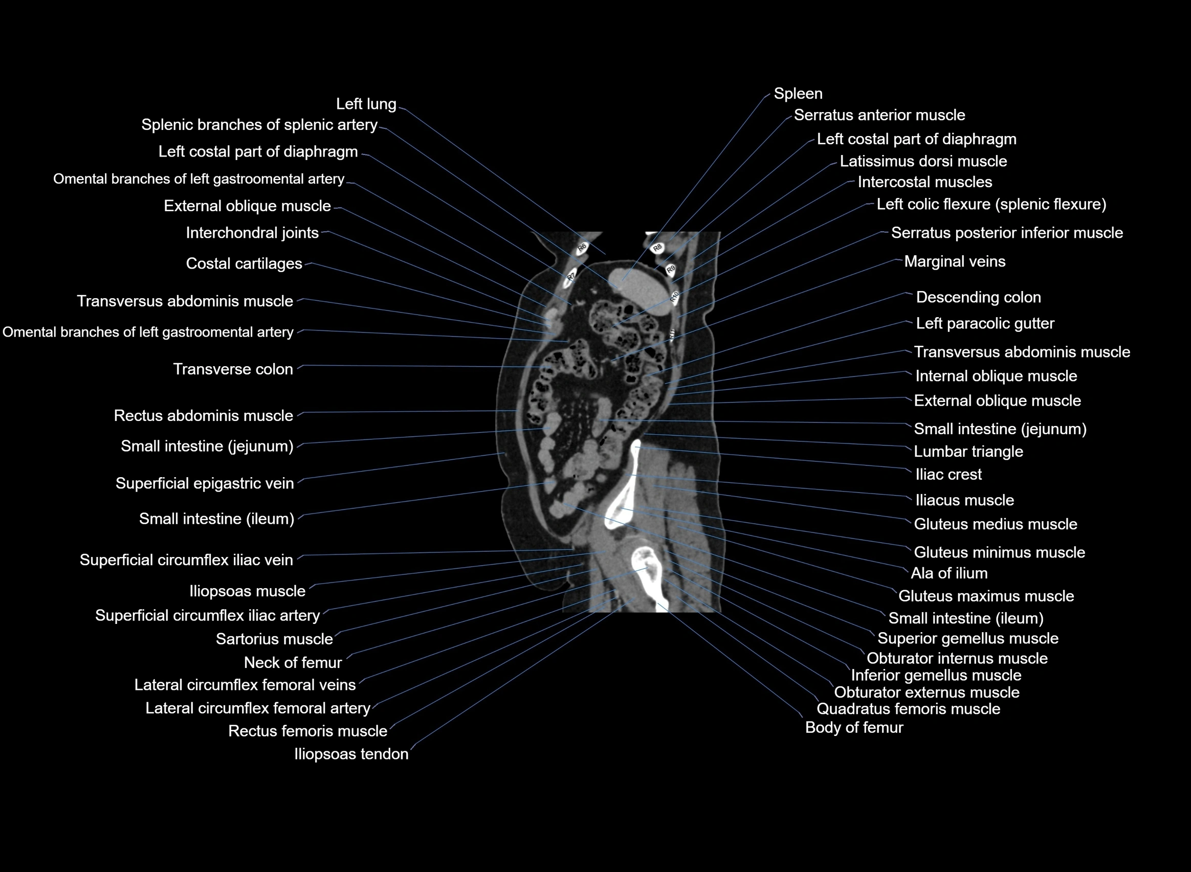 CT Abdomen sagittal cross sectional anatomy labelled radiology image -00023.webp